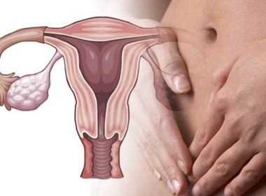 Фото: Дисфункция яичников