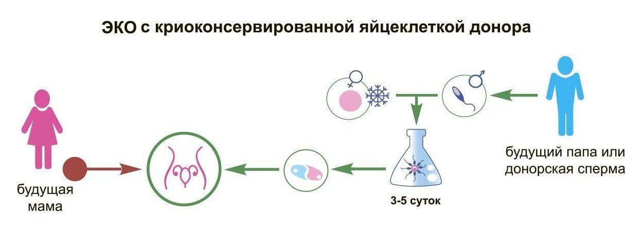 Фото: Лечение бесплодия при дисфункции яичников