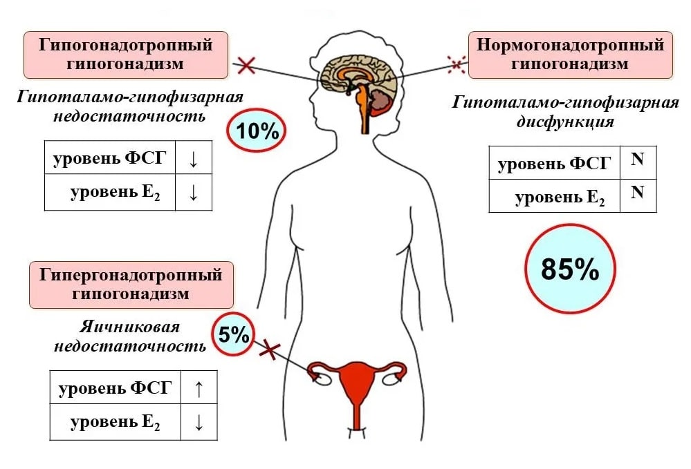 Фото: Дисфункция яичников и ФСГ