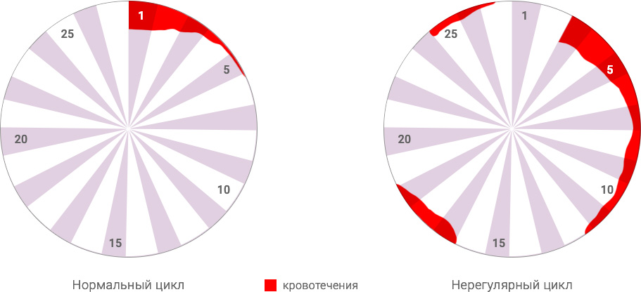Фото: Нерегулярный менструальный цикл