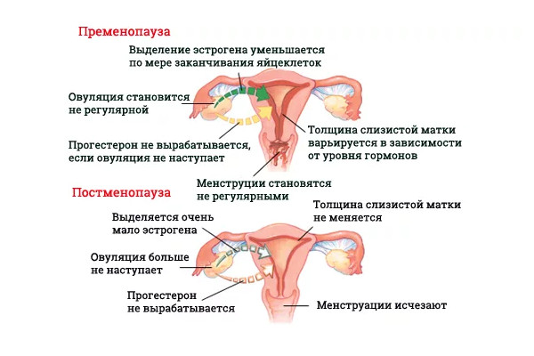 Фото: Можно ли забеременеть при раннем климаксе